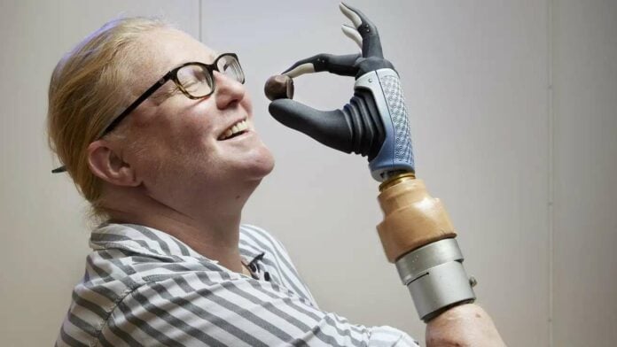 Bionic Hand