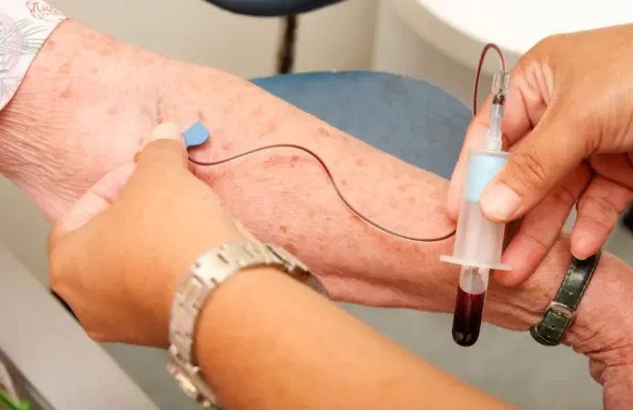 Doctor reviewing Alzheimer’s blood test results showing early diagnosis biomarkers in patient sample